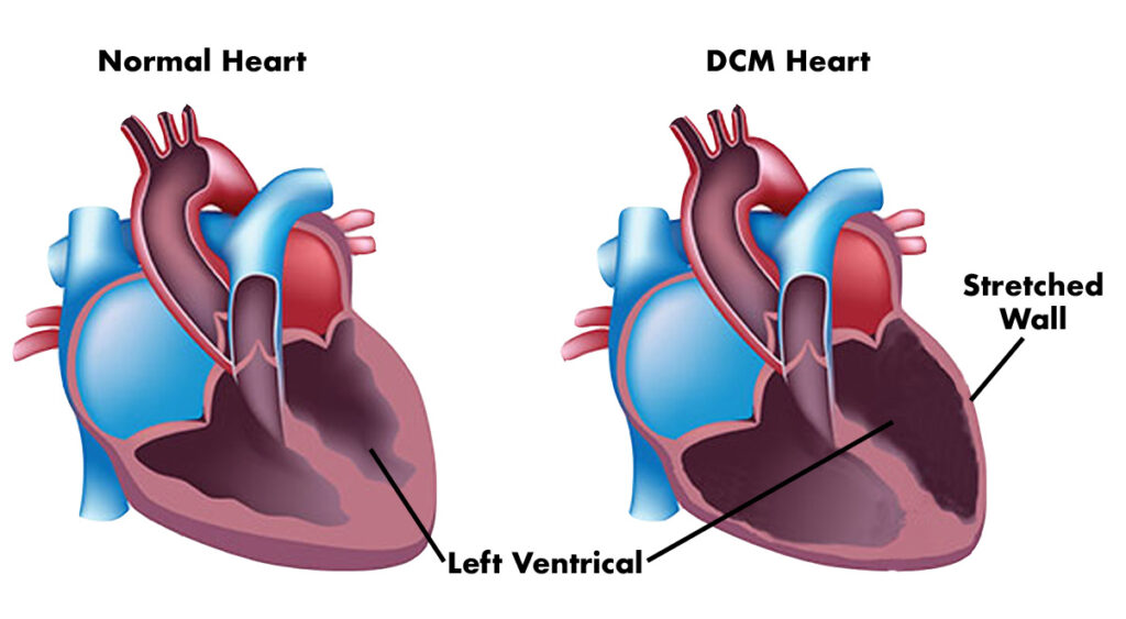 Prognosis – LMNA Cardiac